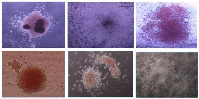 Photos of purple and brown-hued hematopoietic cell colonies
