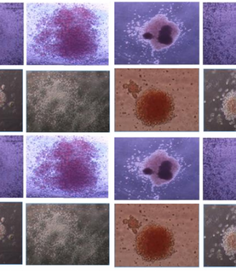 Photos of purple and brown-hued hematopoietic cell colonies